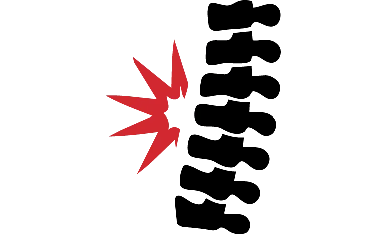 Personal Injury Lawyers Serving The Northwest Territories 21 Spinal Injuries